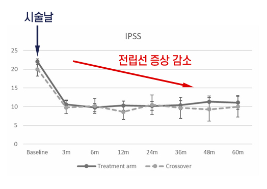 시술시간의 단축