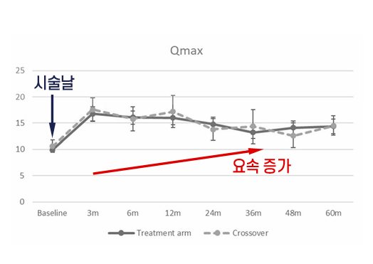 시술시간의 단축